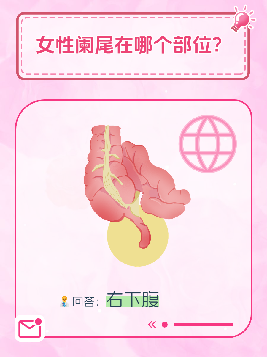 阑尾炎 女性图片