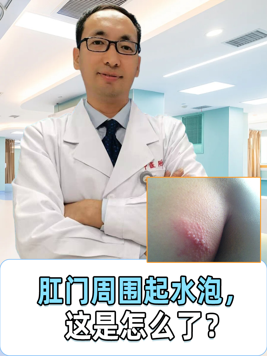 疱疹:肛门周围起水疱可能是生殖器疱疹的表现,这是一种