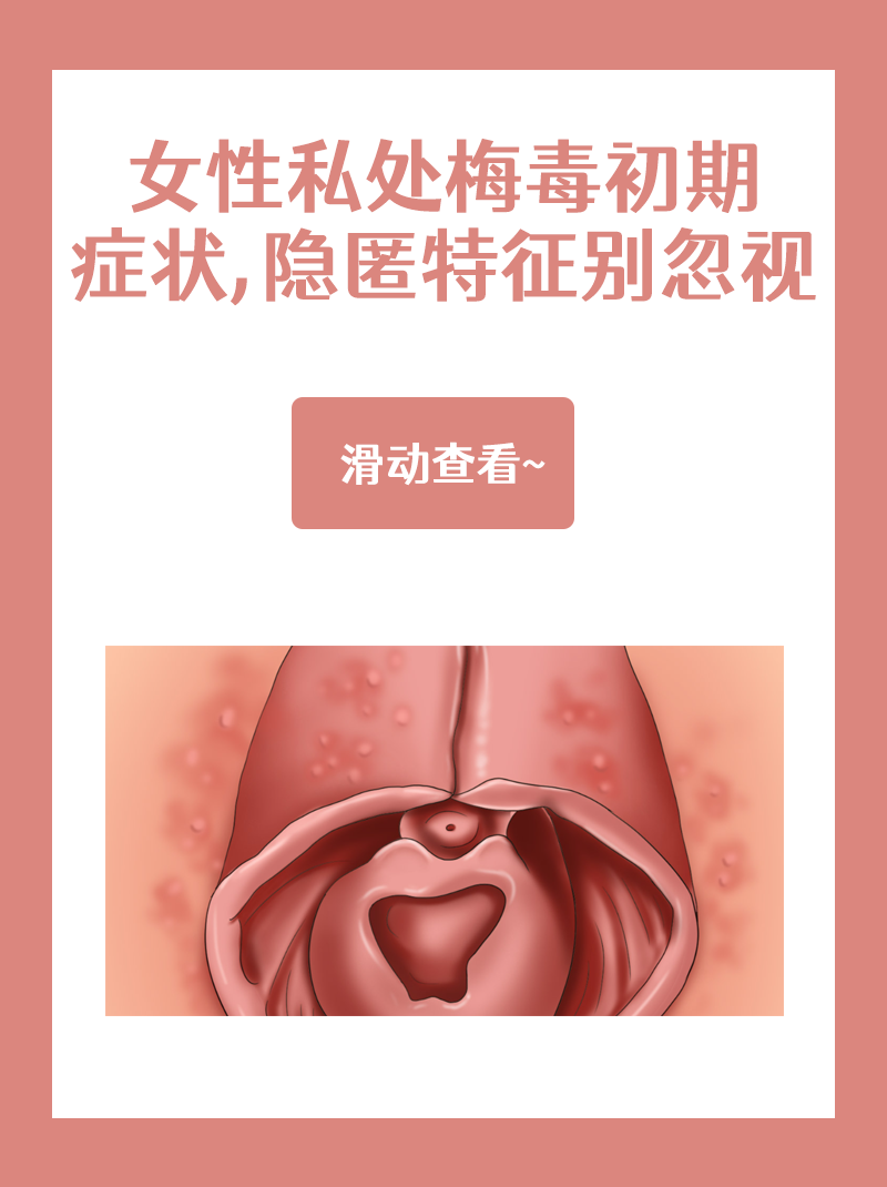 女性私处梅毒初期症状 无痛性溃疡 皮疹出现 全身轻微反应