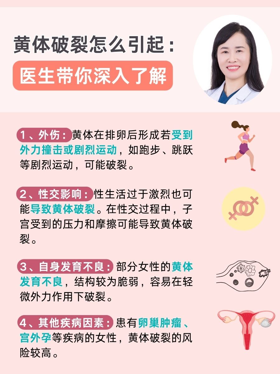 黄体破裂怎么引起:医生带你深入了解