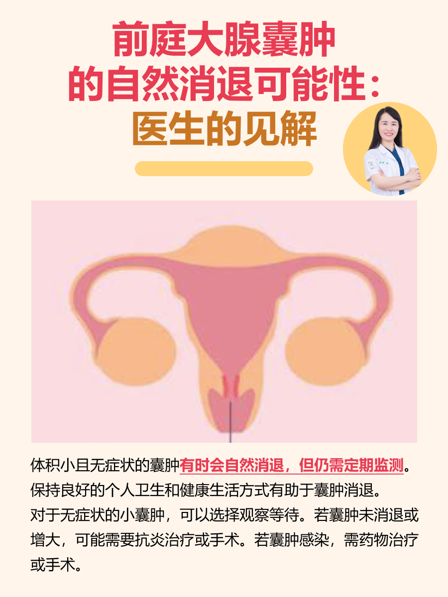 前庭大腺囊肿的自然消退可能性:医生的见解 前庭大腺囊肿,作为一种