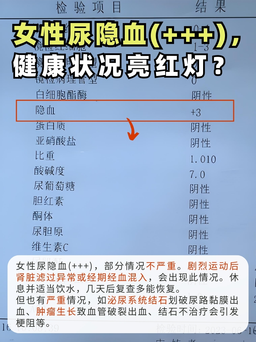 剧烈运动可致身体应激,使肾脏血液循环异常,肾小球滤