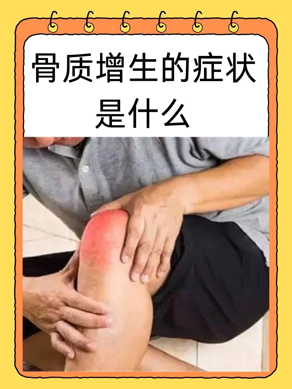 那么骨质增生究竟有哪些症状呢?让我们一同来探寻.
