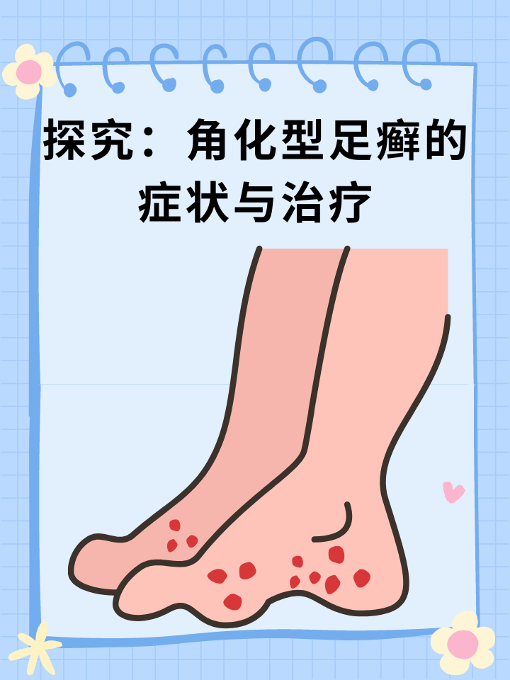 然而,角化型足癣的具体症状是怎样的呢?
