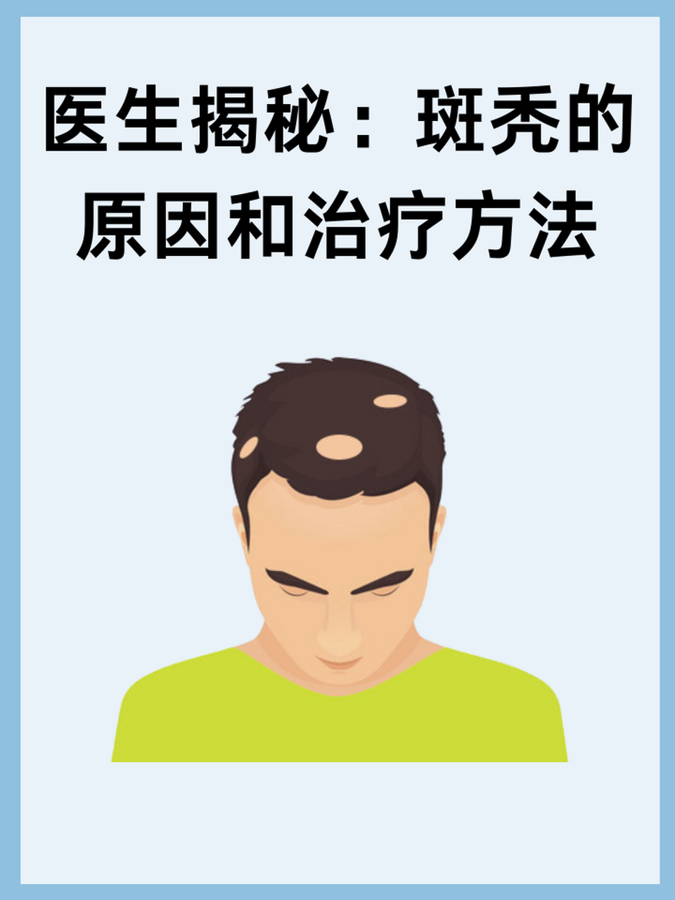 97医生揭秘:斑秃的原因和治疗方法 67斑秃,这个让许多人谈之色变