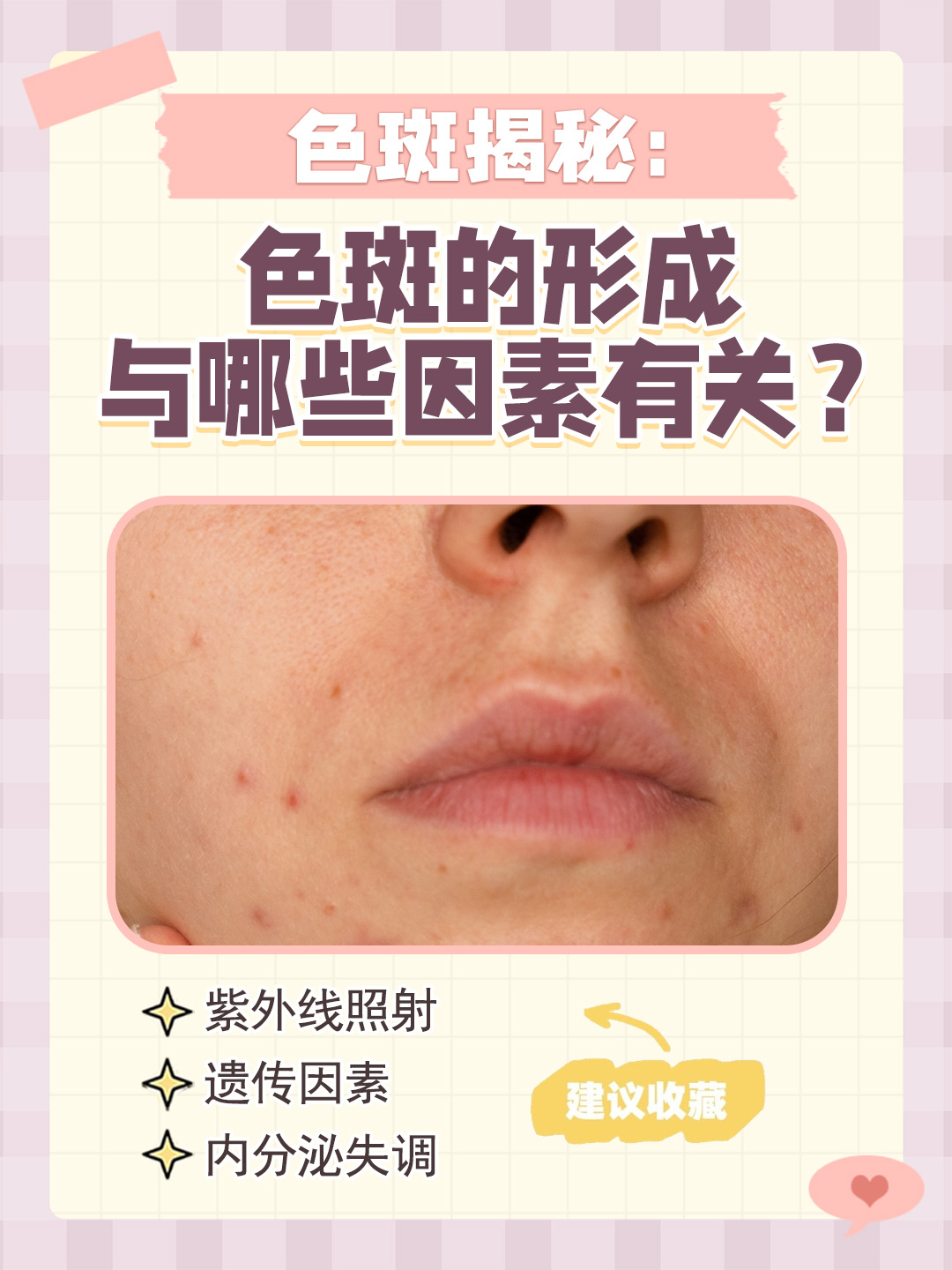 色斑是指与周围皮肤颜色不同的斑点属于色素障碍性皮肤病的一种