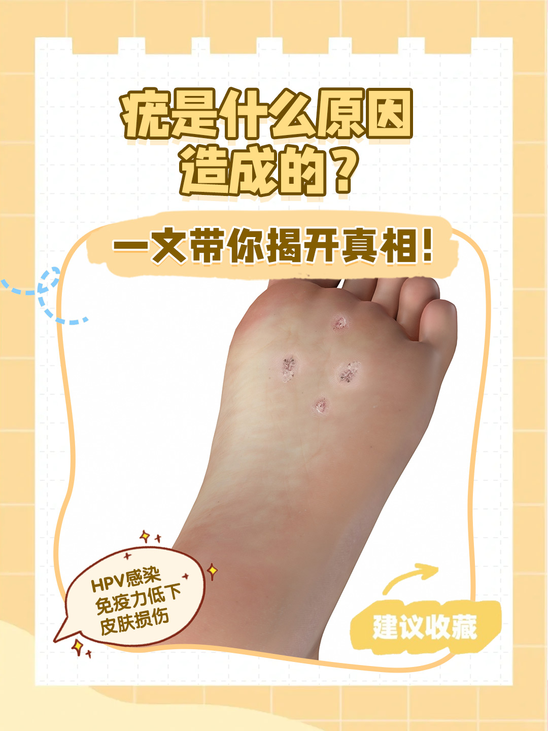 那么,疣究竟是由什么原因造成的呢?