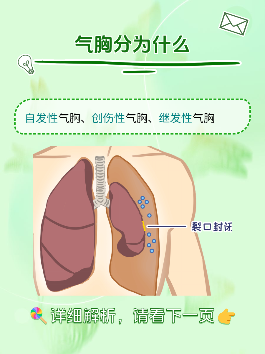 气胸线怎么看图片