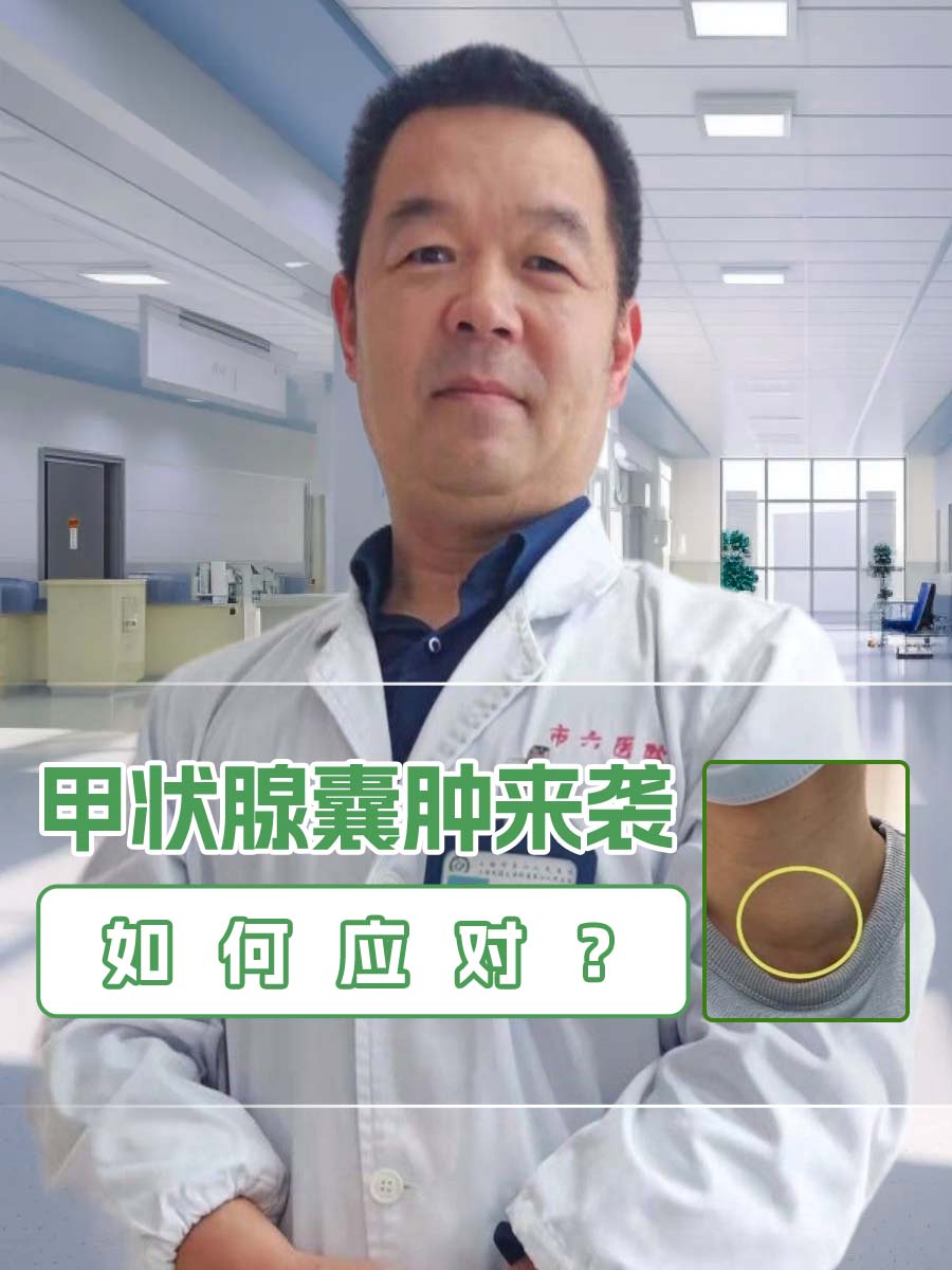甲状腺囊肿来袭,如何应对?