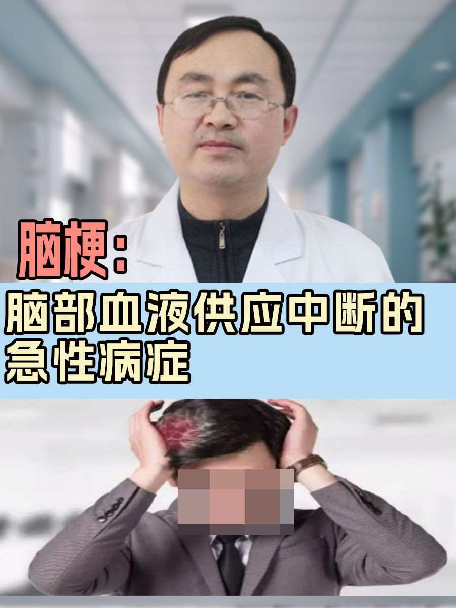 脑梗:脑部血液供应中断的急性病症