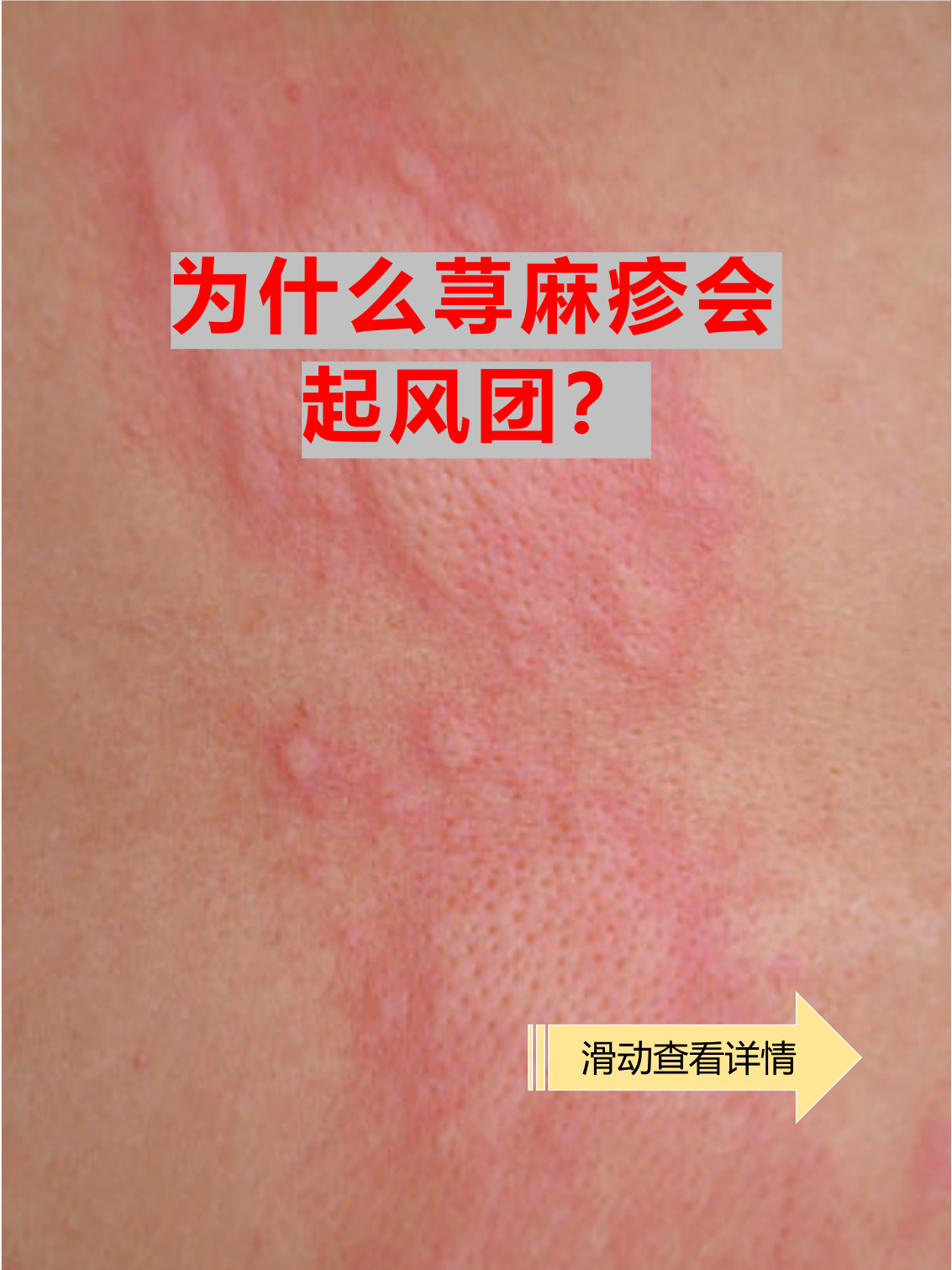 为什么一到夏天皮肤就痒 为什么一到夏天皮肤就痒