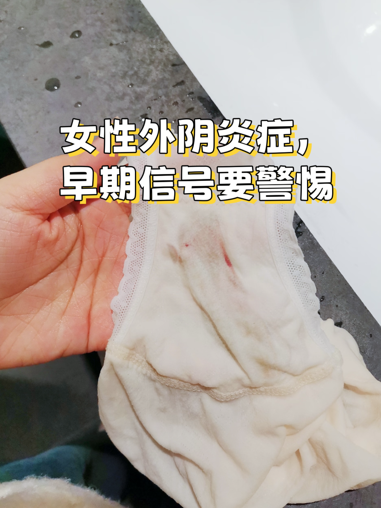 女性外阴炎症,早期信号要警惕