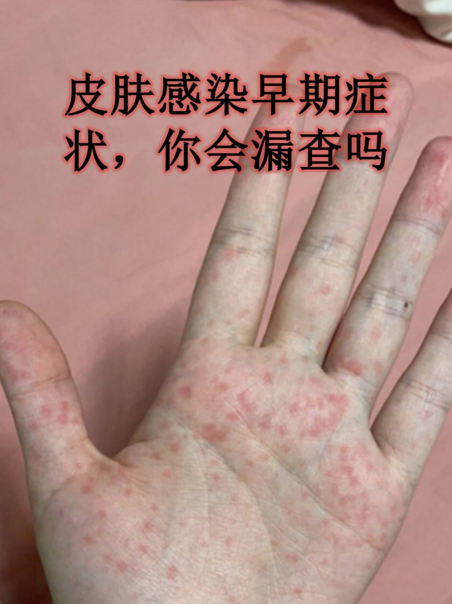  新型冠状病毒几年前就有了症状吗(新冠病毒去年就有了)