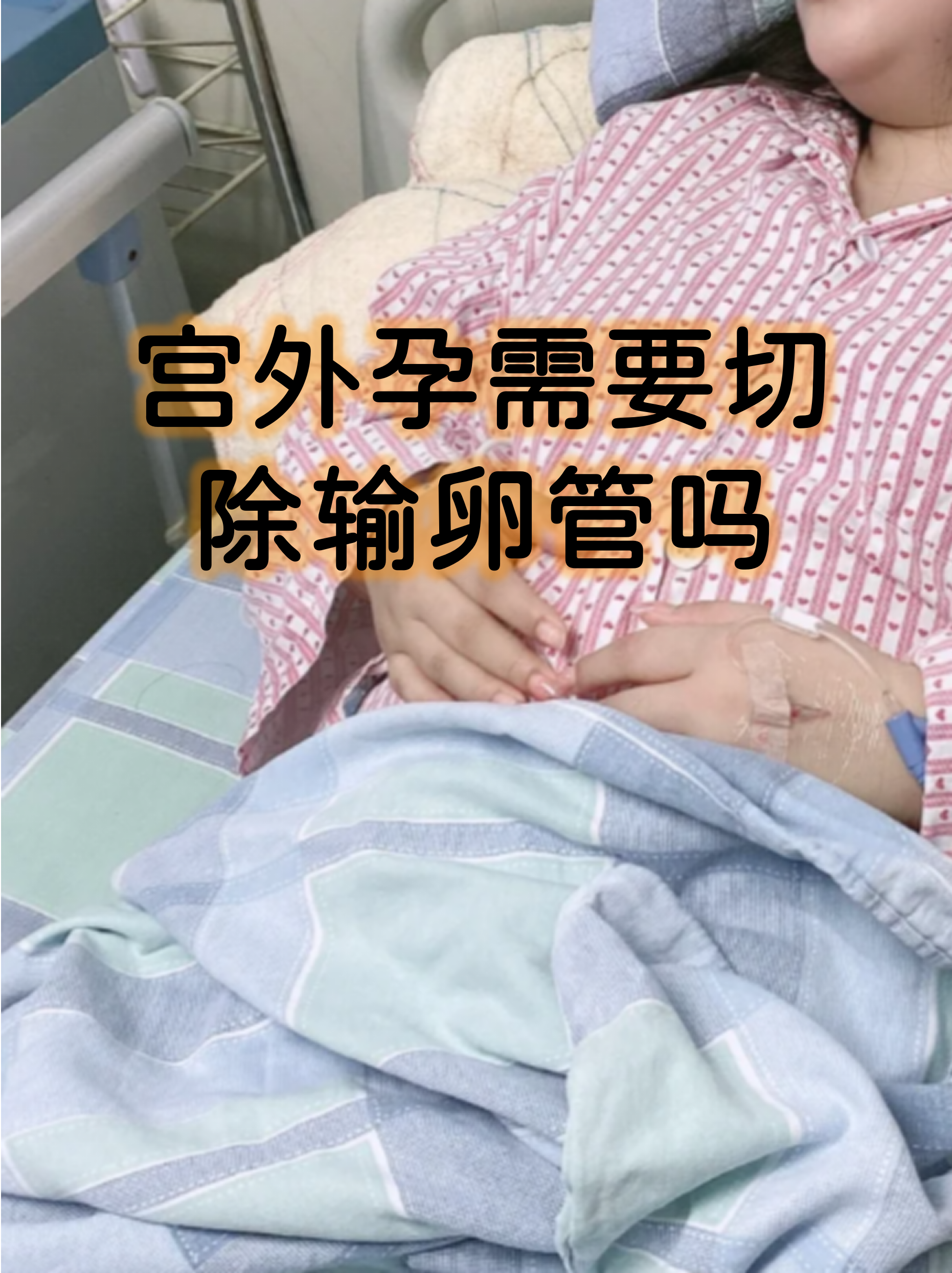 宫外孕需要超度吗-宫外孕需要做什么手术