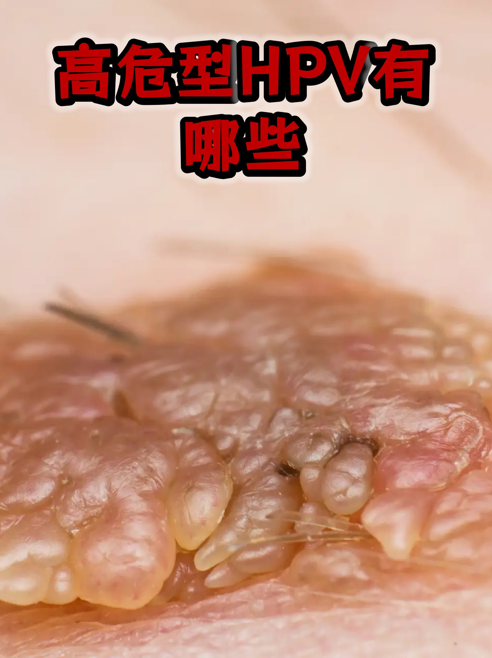  现在最严重的相关病毒在哪里(腺病毒17天表现症状图)