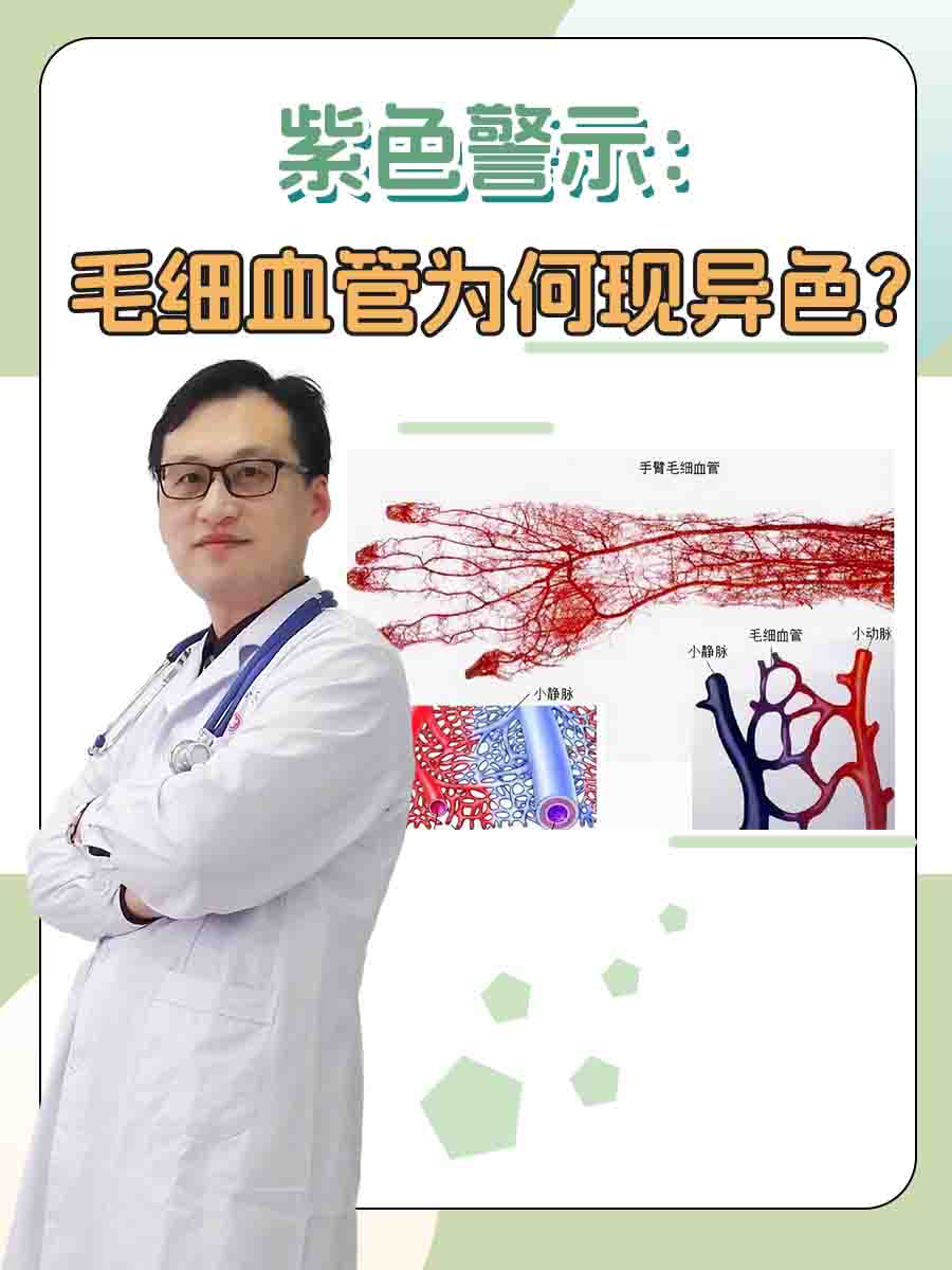 在日常生活中,偶尔会注意到皮肤下的毛细血管呈现出异常的紫色.