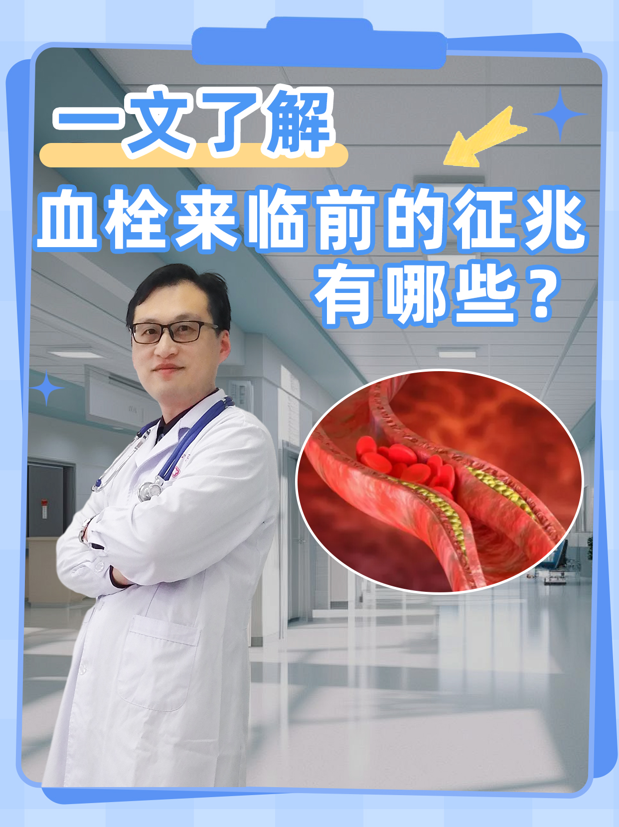 血栓来临前的征兆有哪些?