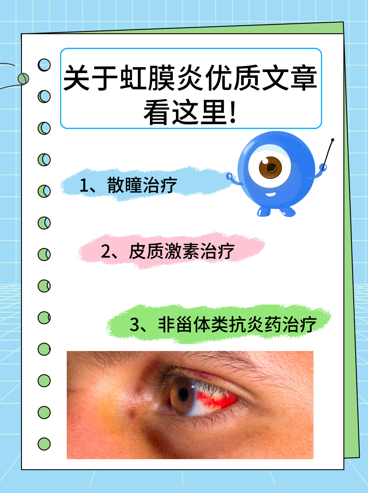 虹膜炎怎么治疗 虹膜炎,作为一种较为常见的眼部炎症