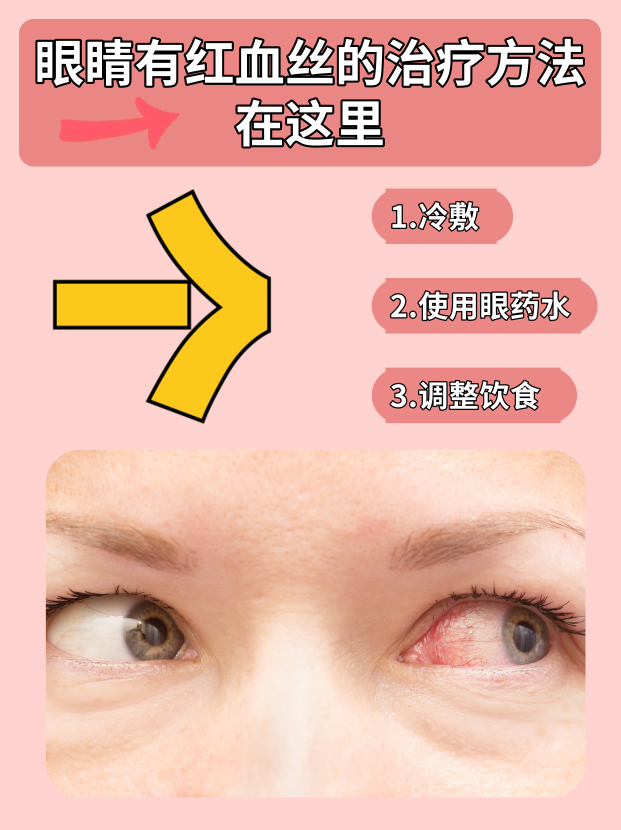 眼睛为什么会红出现血丝为什么在线