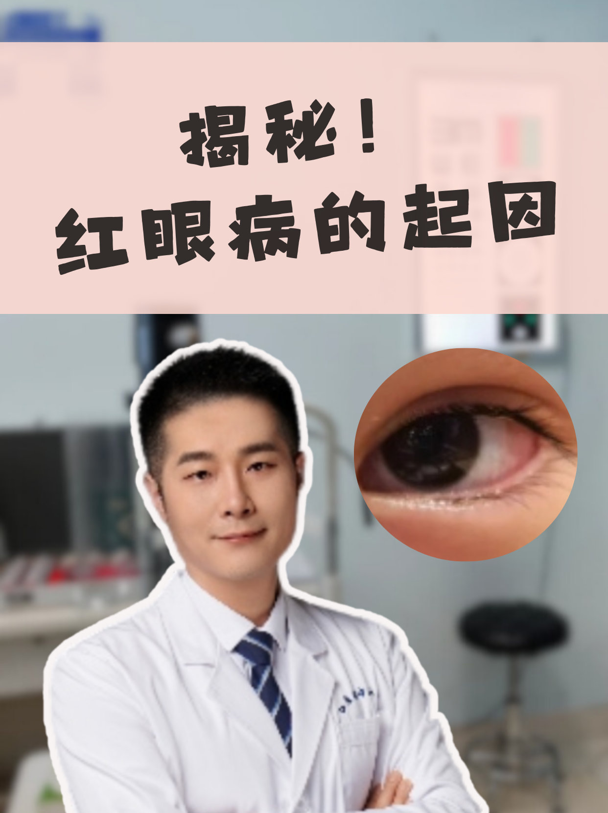 这就是传说中的红眼病哦!遇到这样的情况,大家要赶紧去医院检查!