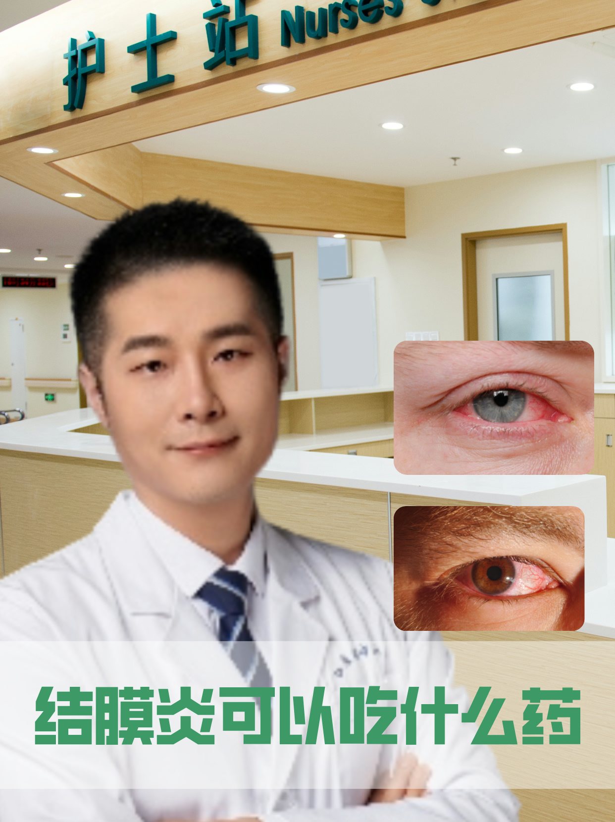 结膜炎的治疗需要根据病因进行正确的药物治疗,以下分析结膜炎治疗用