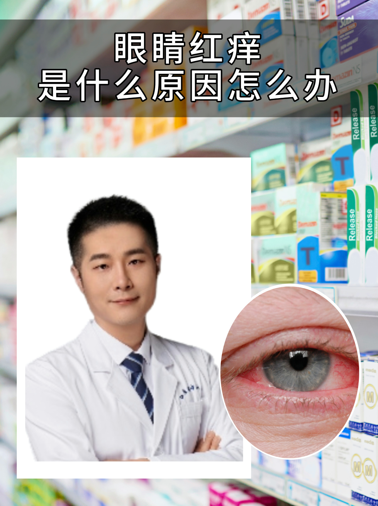 为什么眼睛很痒特别是眼角为什么在线 为什么眼睛很痒特别是眼角为什么在线