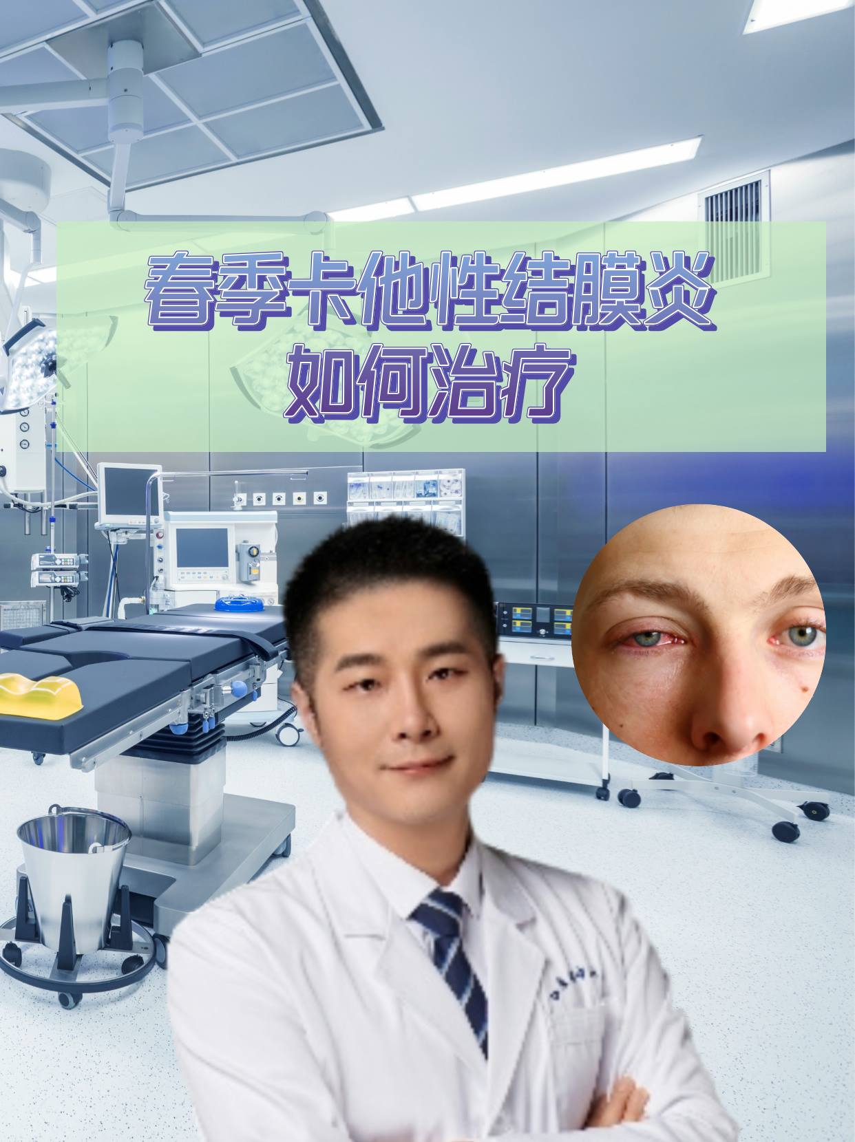 春季卡他性结膜炎如何治疗 春季卡他性结膜炎,也称为春季角结膜炎,是