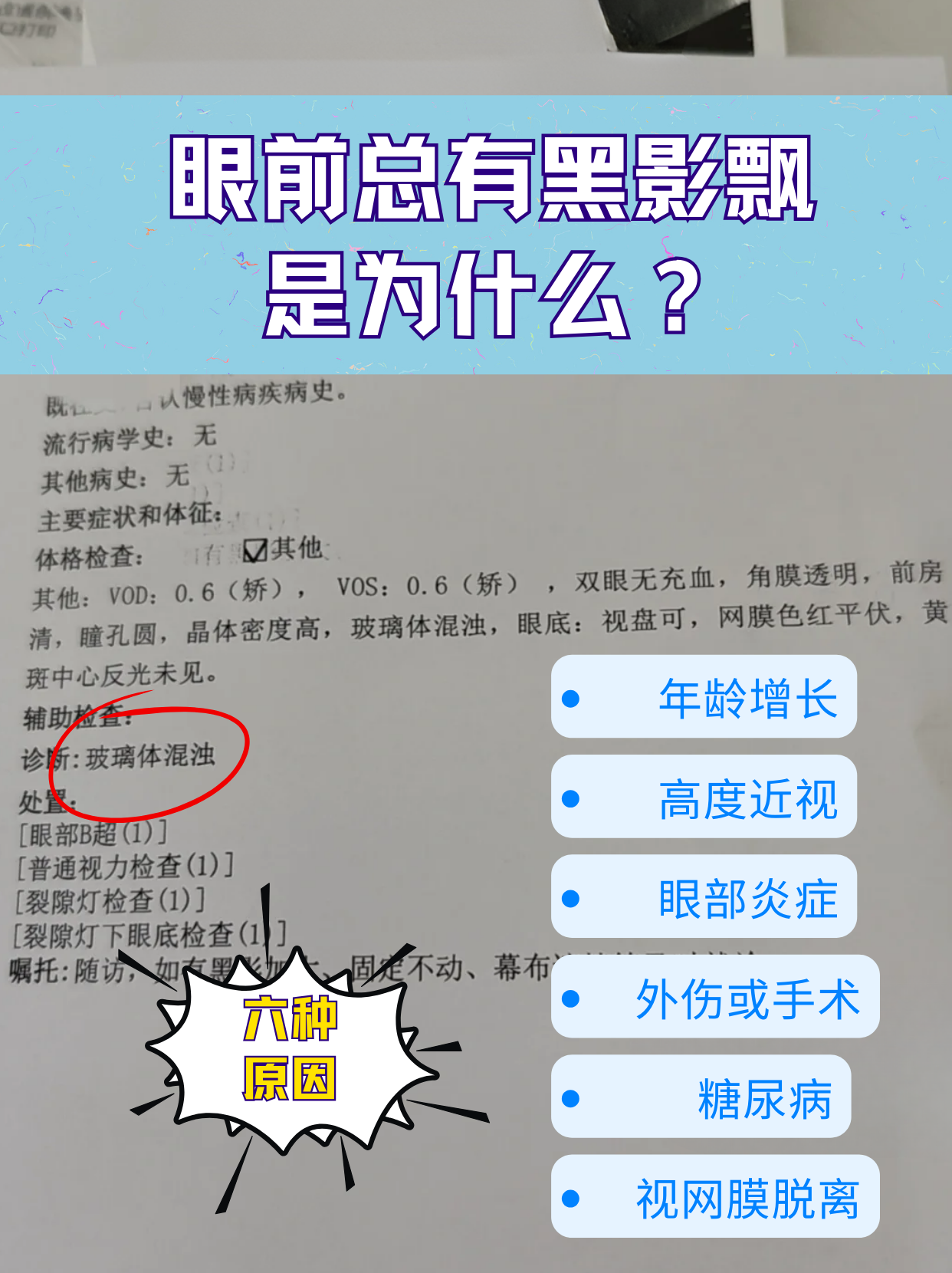 眼前总有黑影飘,医学上称为飞蚊症