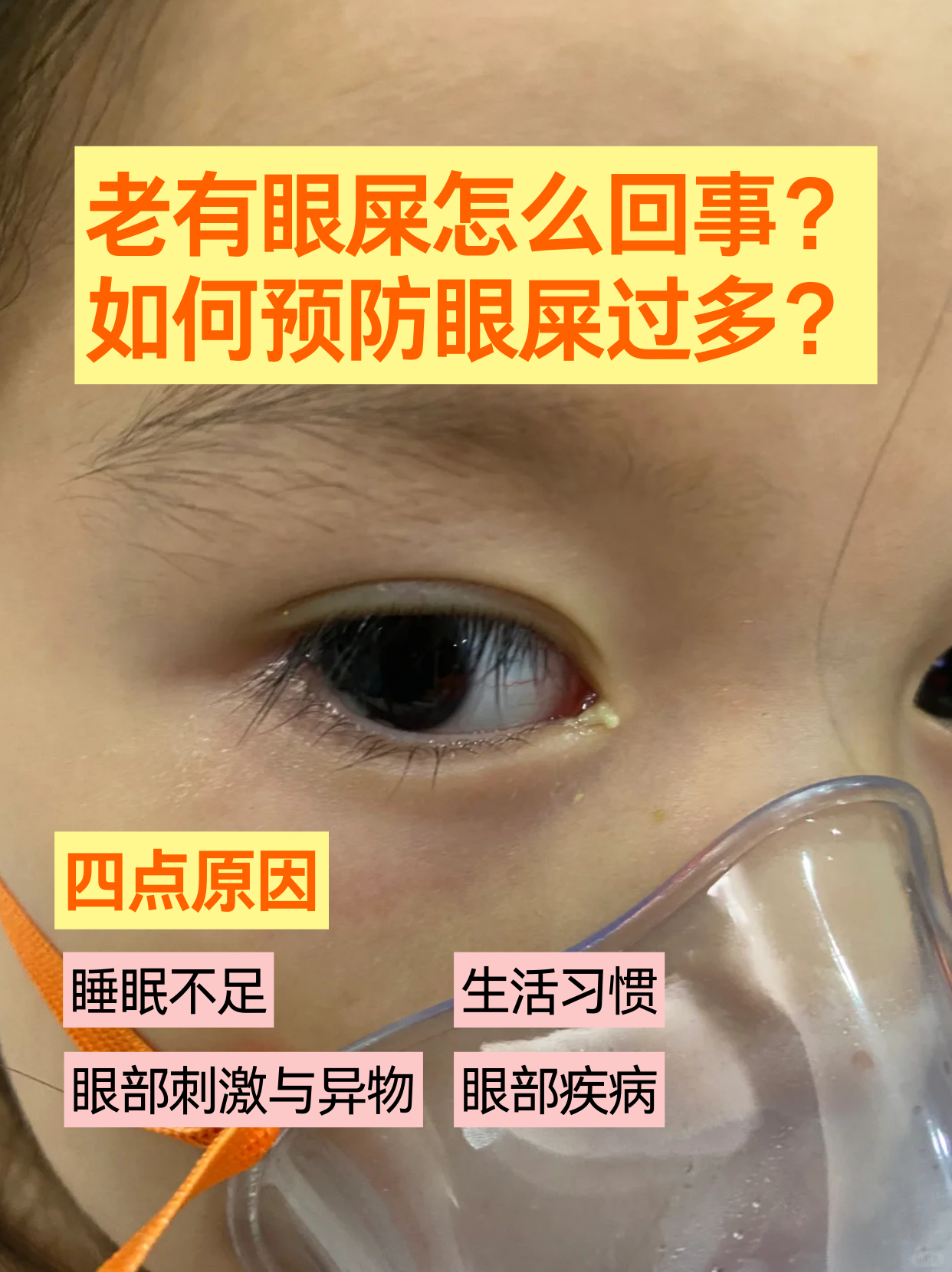 如何预防眼屎过多?