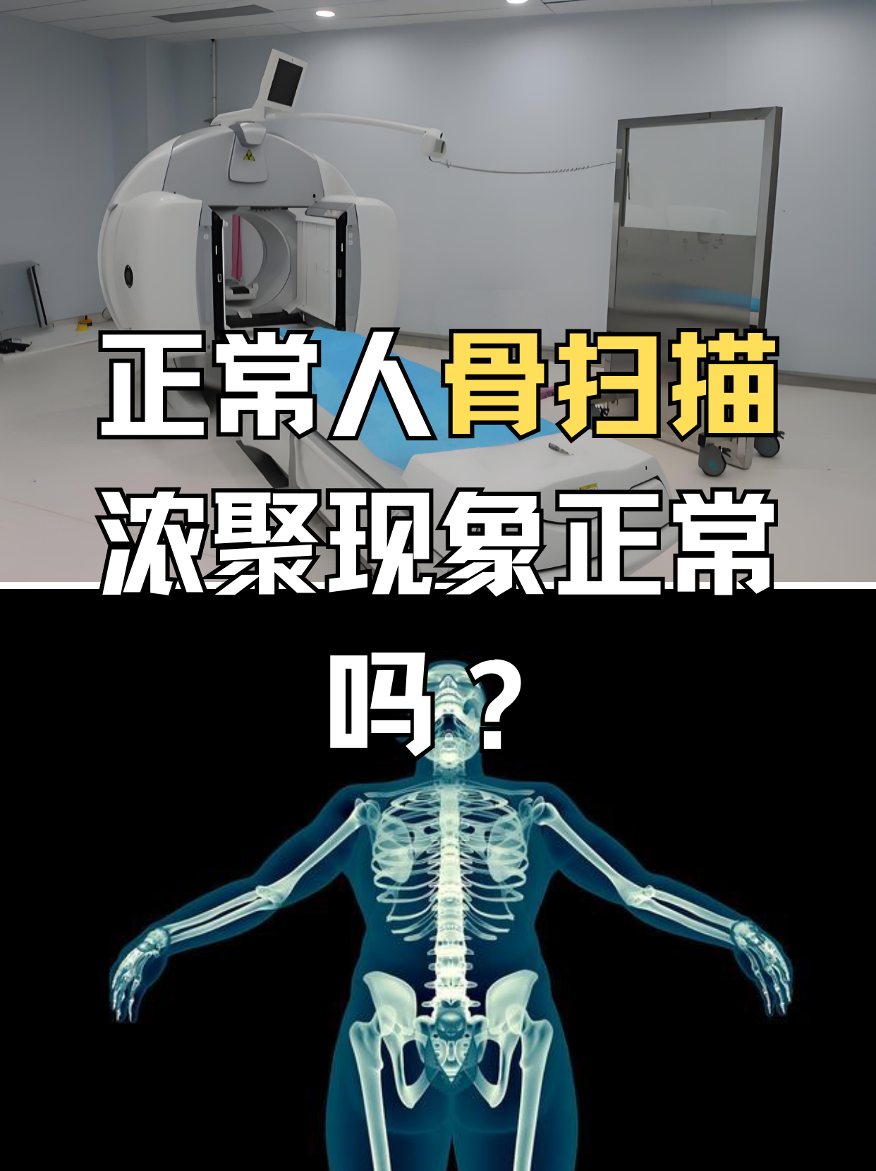 提到骨扫描,或许很多人会感到陌生