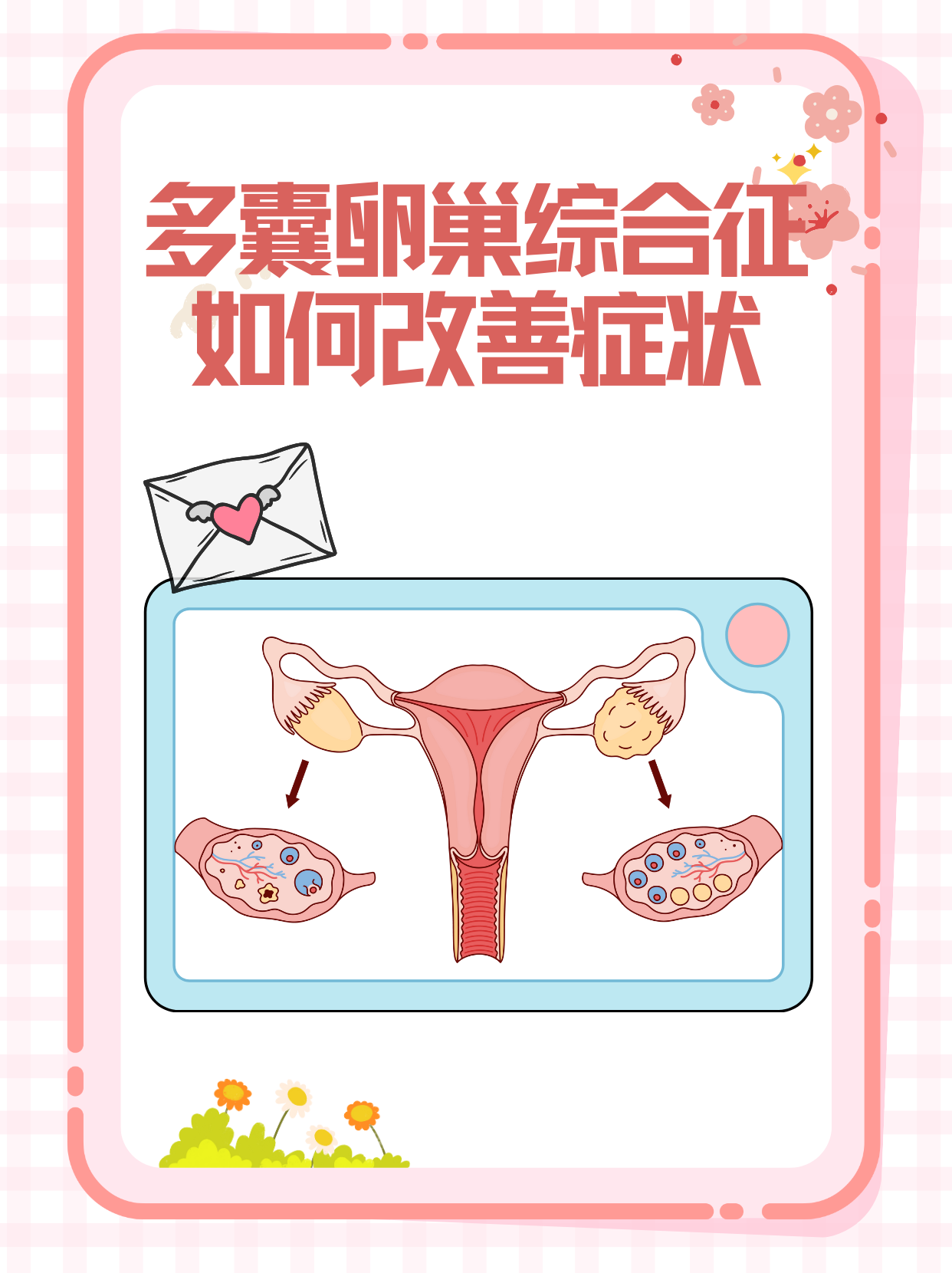 多囊性卵巢综合症是怎么引起的_多囊性卵巢综合症是什么原因造成的