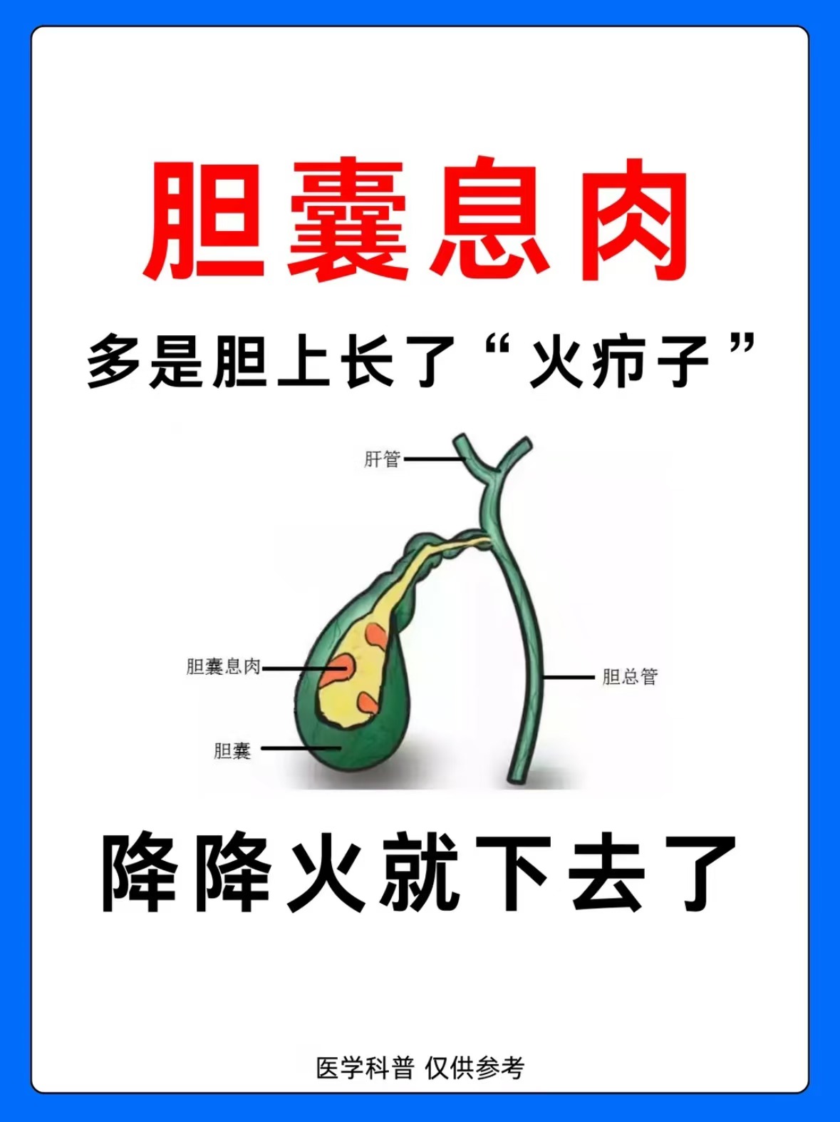 为什么会有胆囊息肉 为什么会有胆囊息肉