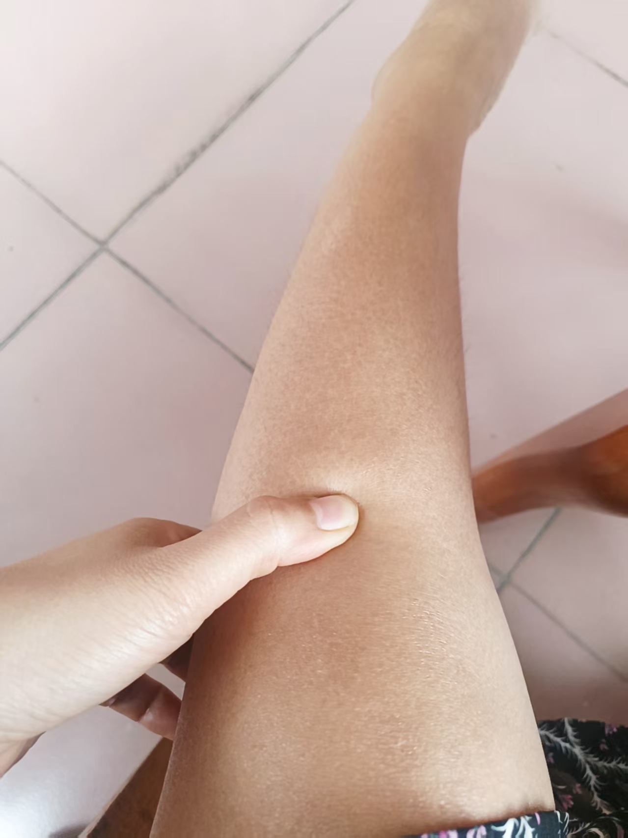 足三里穴位于小腿外侧犊鼻穴也就是外膝眼下3寸胫骨前嵴外1横指处