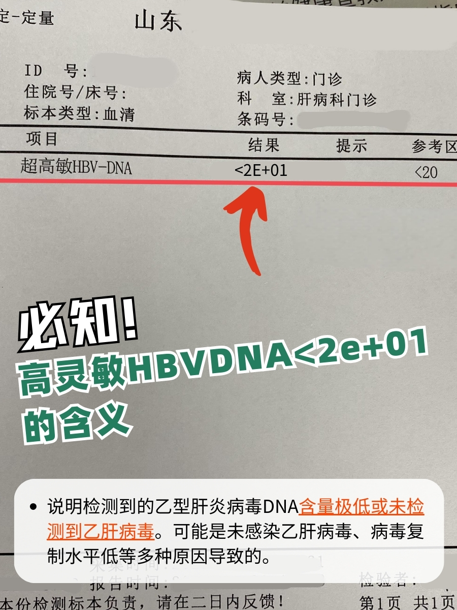 高灵敏hbvdna<2e 01的含义