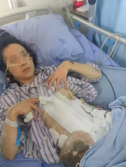 2年内被家暴16次女子发声