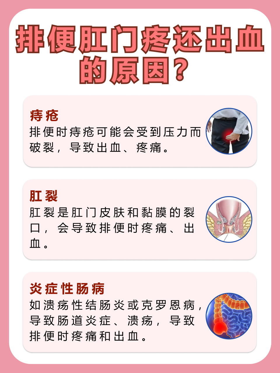 肛门疼痛与出血:排便时的常见问题  07在日常生活中,排便时出现肛门