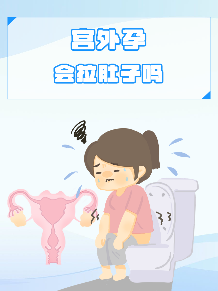 为什么宫外孕会发生 为什么宫外孕会发生