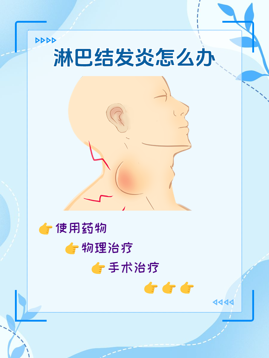 怎么会长淋巴结的原因为什么在线