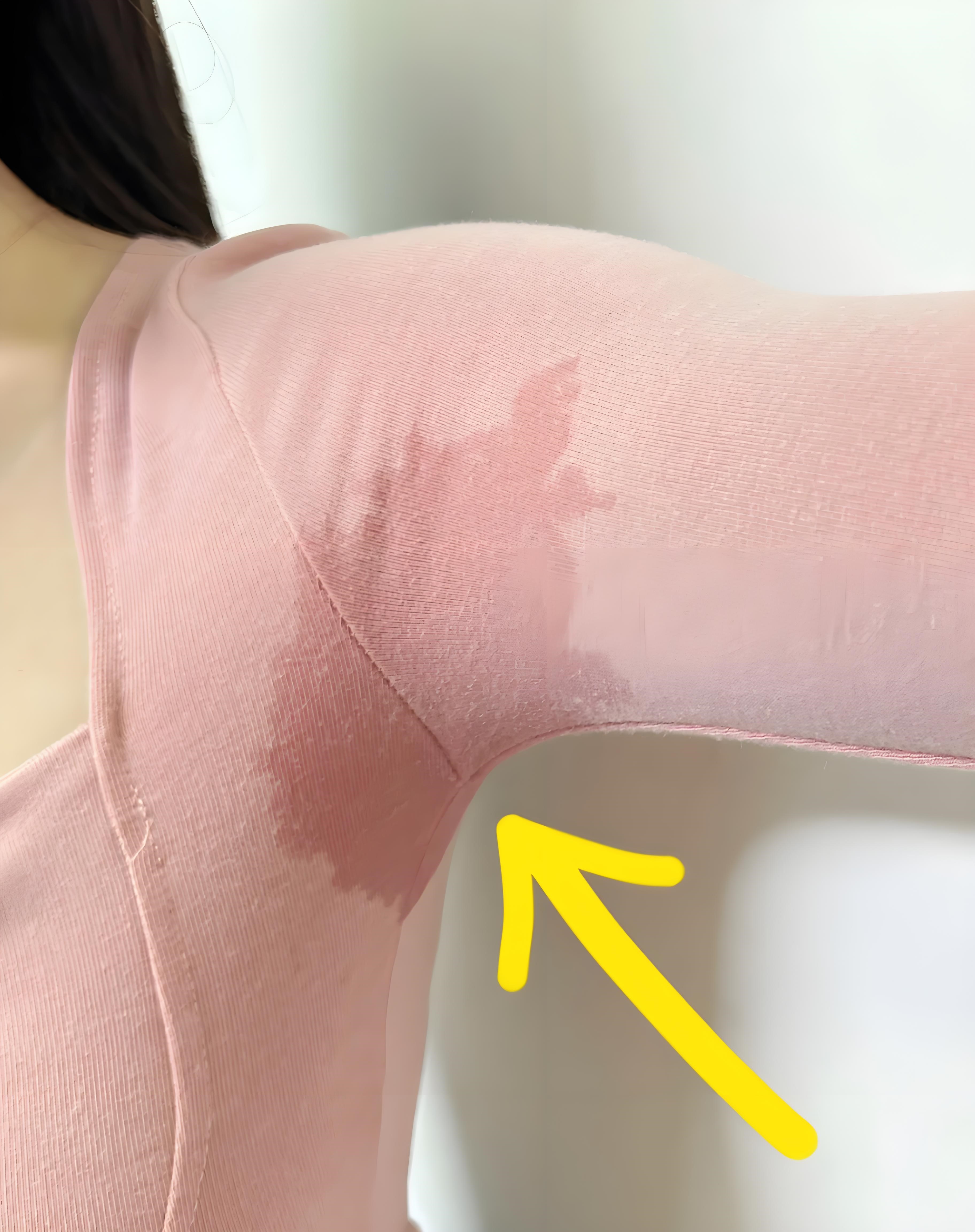 为什么腋下臭老鼠一样臭百科在线 为什么腋下臭老鼠一样臭百科在线