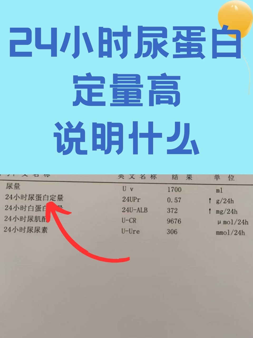 尿蛋白高是怎么回事图片