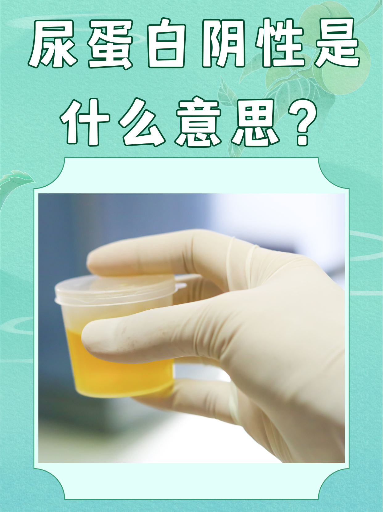 尿蛋白阴性是什么意思?  尿蛋白的检测对于评估肾脏健康状态尤为重要.