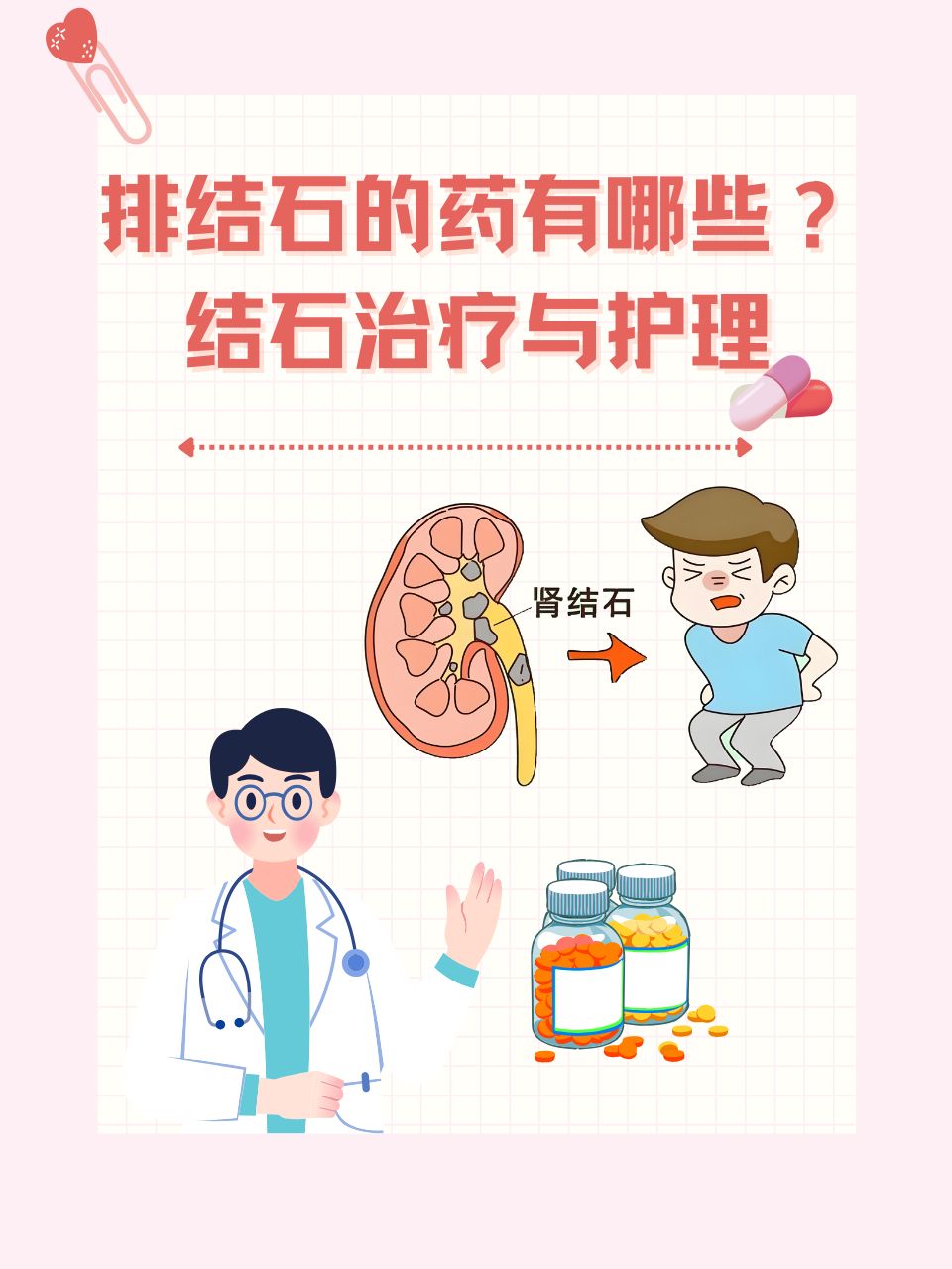 哪些方法可以帮助排结石的简单介绍