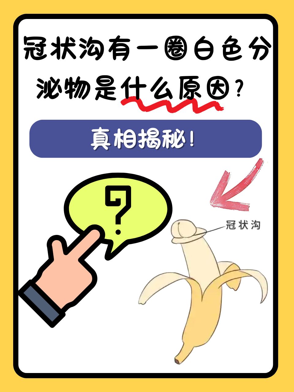 不少男性朋友日常生活中都可能会发现自己的冠状沟出现了一圈白色