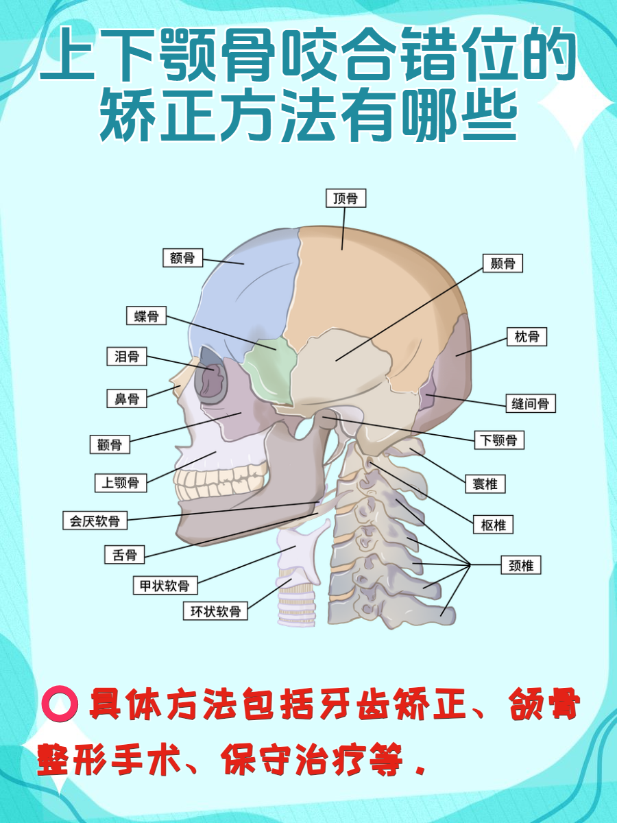 颌骨矫正图片