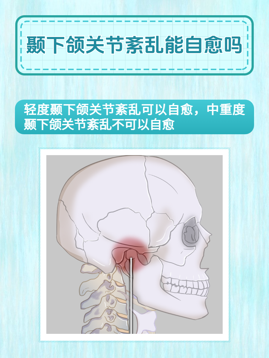 颞颌关节炎症状图片