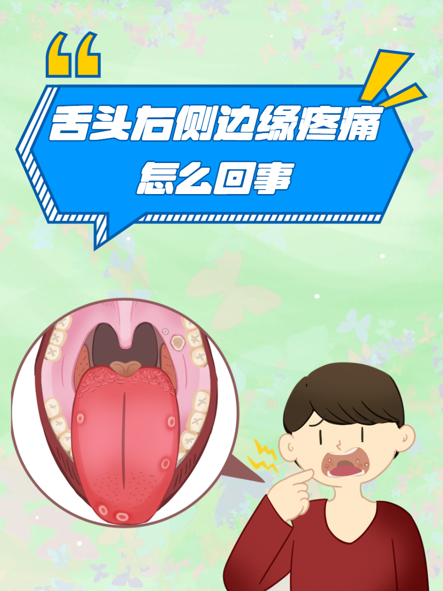 舌头右侧边缘疼痛怎么回事?