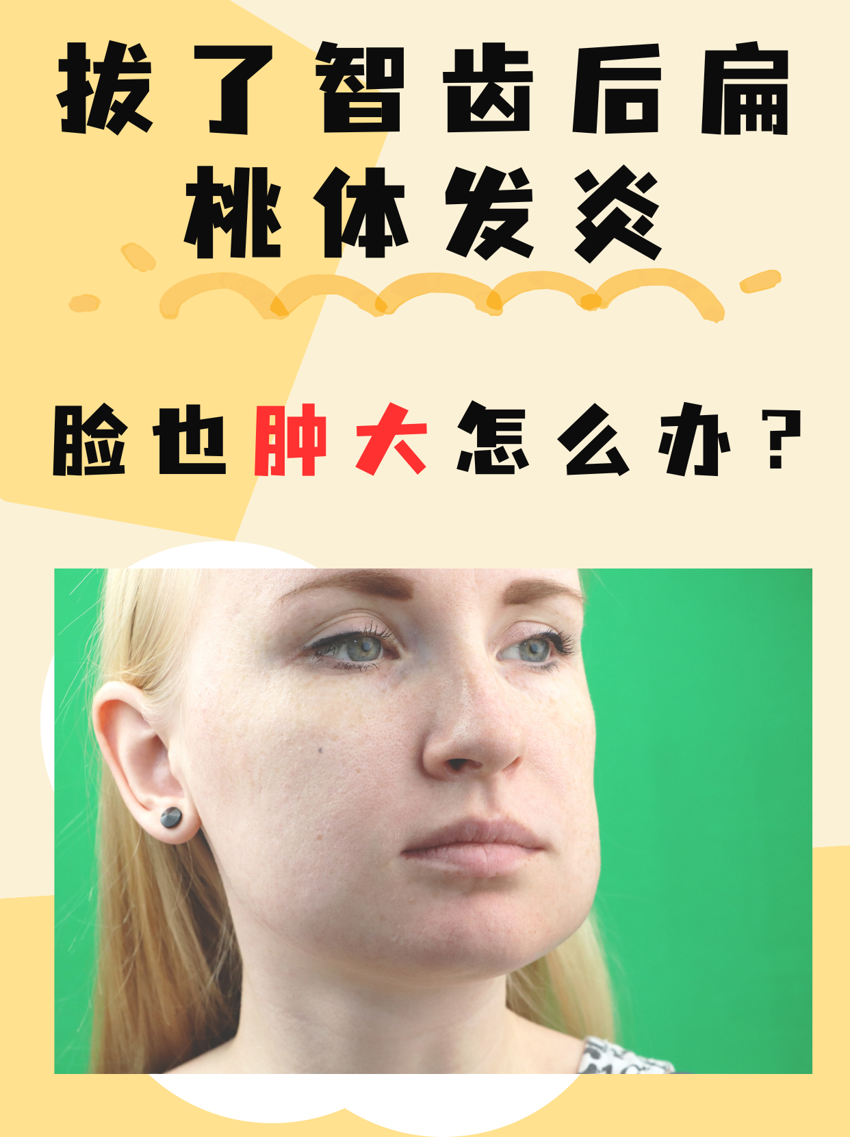 扁桃体发炎一直没好什么原因?百科在线