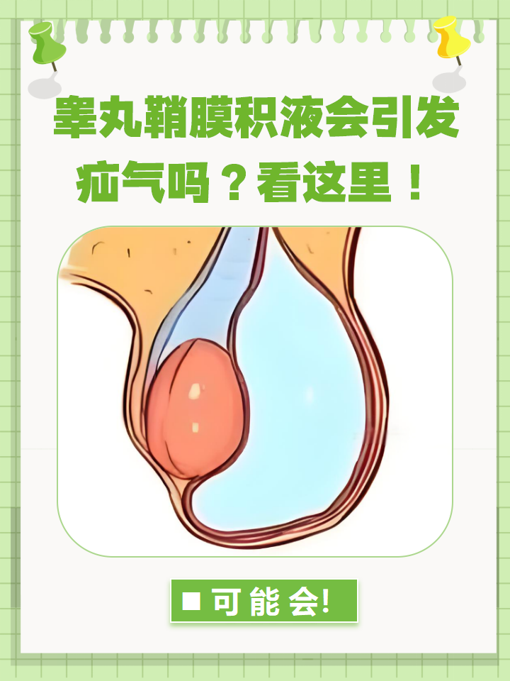 你是否知道睾丸鞘膜积液和疝气的关系?
