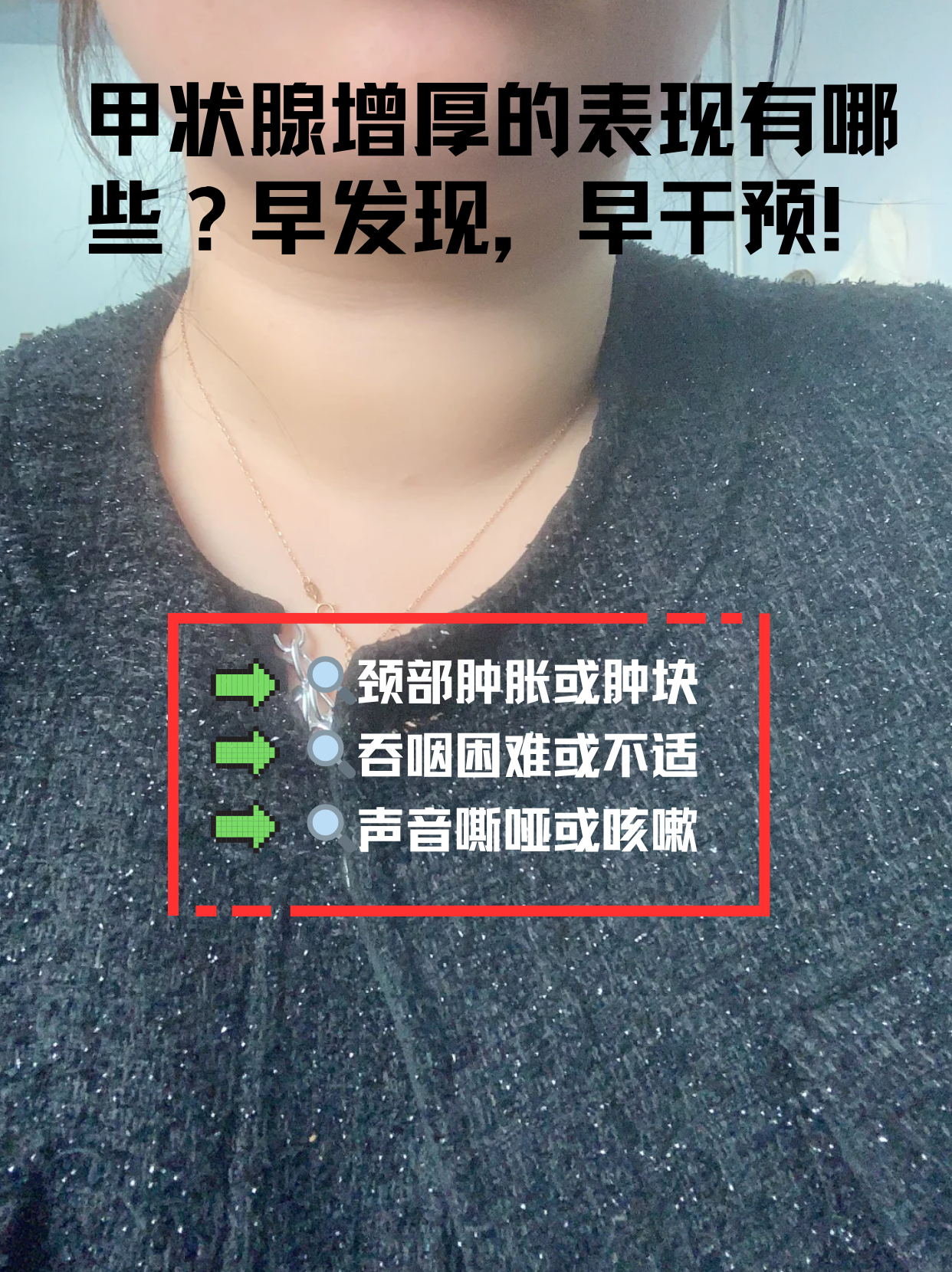 关于原空军总医院代诊挂号服务流程检验结果异常及时告知,早做处理的信息 关于原空军总医院代诊挂号服务流程检验结果异常及时告知,早做处理的信息