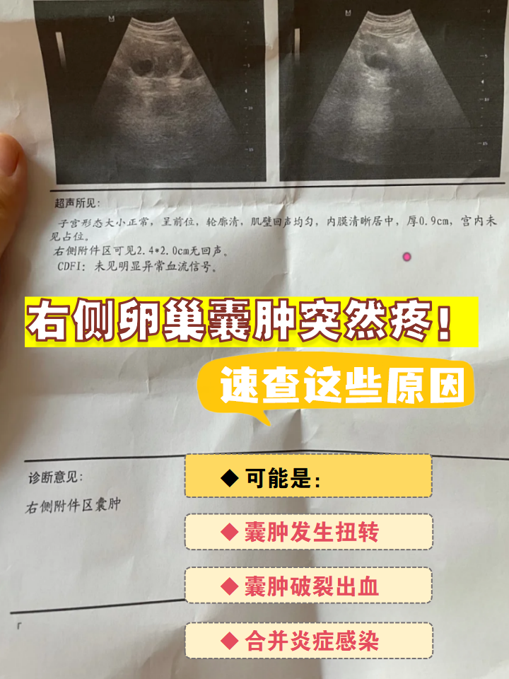 卵巢囊肿一般几年消失百科在线